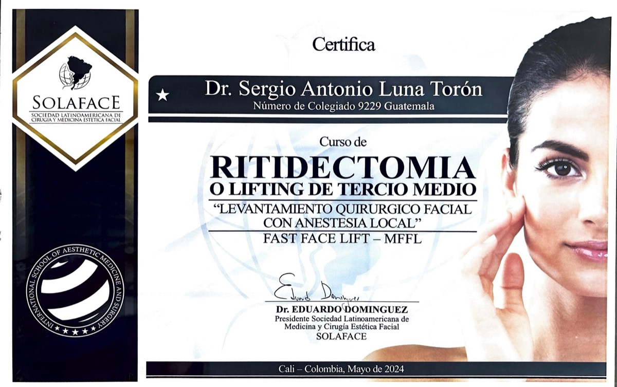 Ritidectomía o Lifting de Tercio Medio – Fast Face Lift